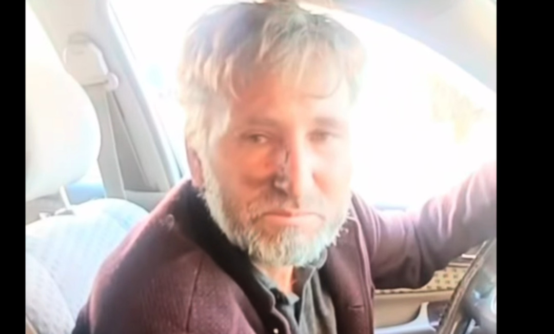 اختطاف طفلة في عين العرب (كوباني) واعتداء على ذويها