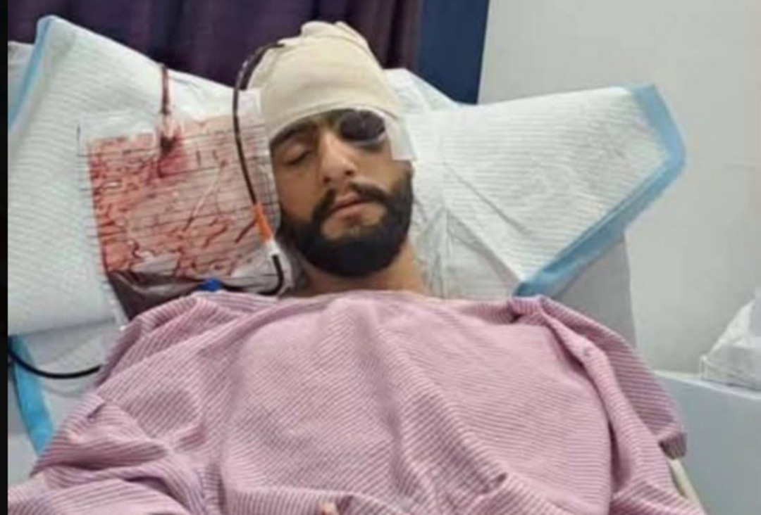 أنس عباس أبن داريا في حالة حرجة إثر اعتداء من عنصر في الأمن العام